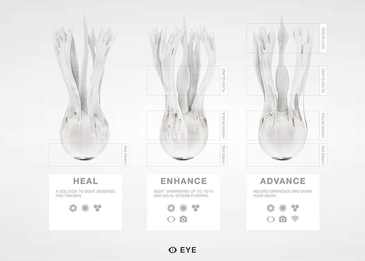 根据MHOX概述的设计，合成眼将有三种不同的型号（上图）