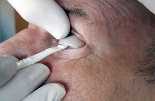 如何去除你的人工眼