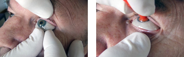 如何将眼睛重新插入插座