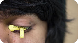 进口高分子义眼